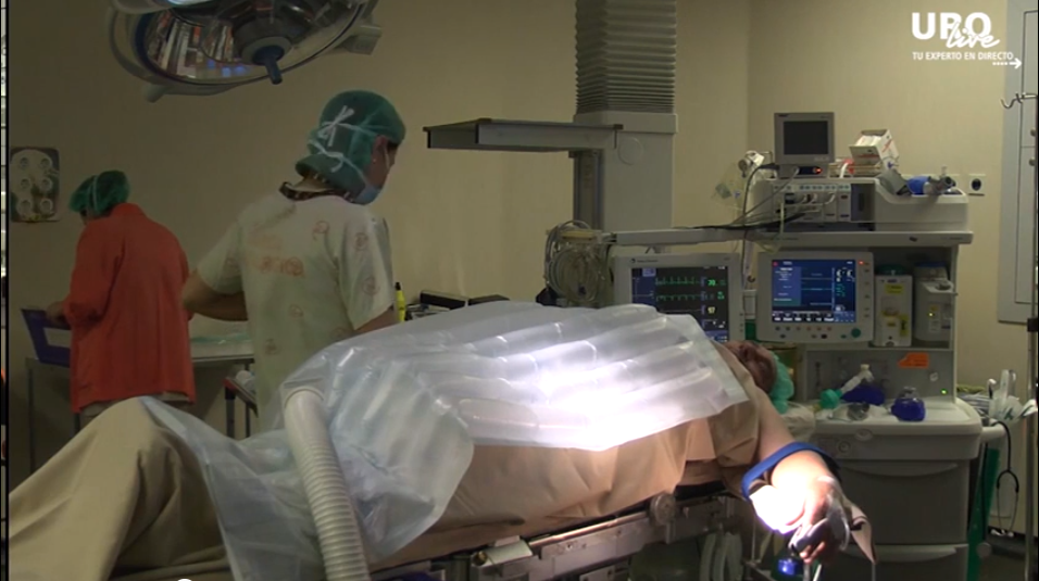 Cirugía Mínimamente Invasiva - Prostatectomía radical robótica con lifadenectomía extendida - Dr. Roberto Ballestero Diego y Dr. David Truhán Cacho